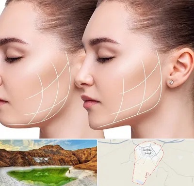 جراحی بوکال فت در گرمسار