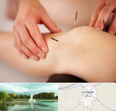 دکتر طب سوزنی برای لاغری در لردگان