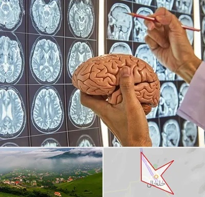 دکتر فوق تخصص جراح مغز و اعصاب در خلخال