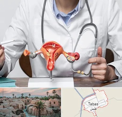 جراح سرطان رحم در طبس