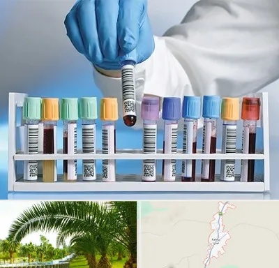 آزمایشگاه شبانه روزی در کهنوج