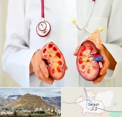 دکتر سنگ کلیه در گراش