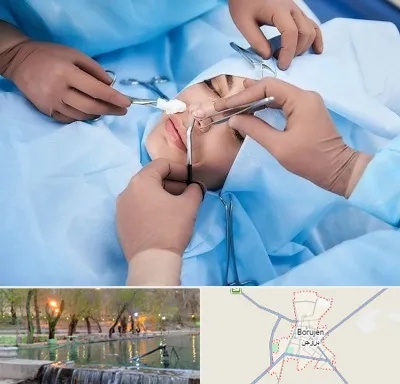 عمل بینی فانتزی در بروجن