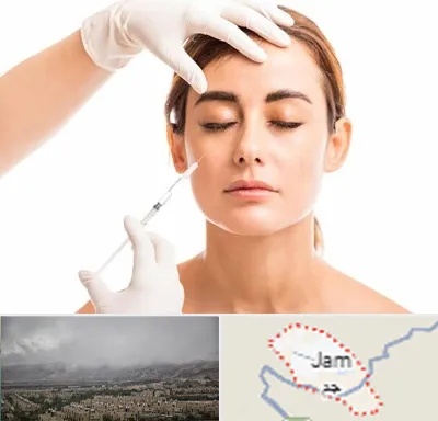 تزریق ژل گونه در جم