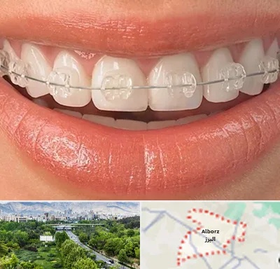 ارتودنسی اقساطی در البرز