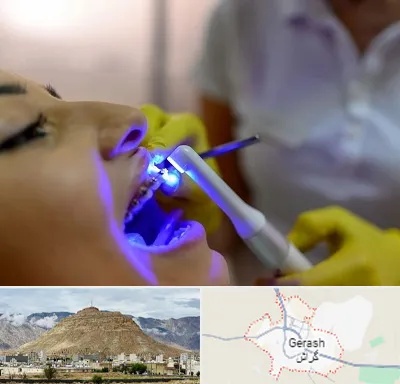 دندانپزشکی با لیزر در گراش