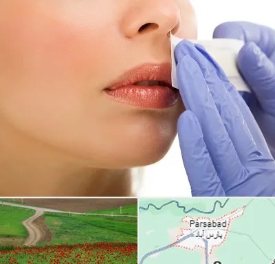 اپیلاسیون صورت در پارس آباد