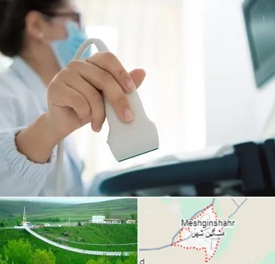 اکوی قلب در مشگین شهر