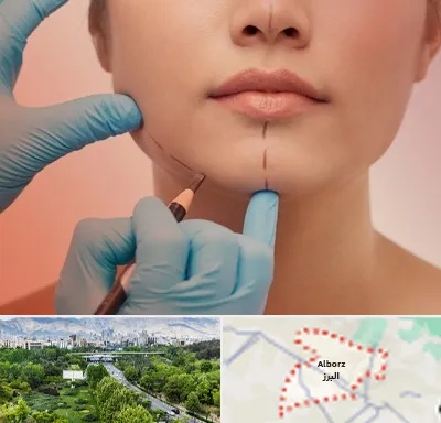 دکتر زیبایی خانم در البرز