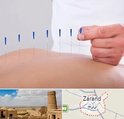 دکتر طب سوزنی در زرند