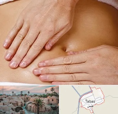 متخصص ناف گیری در طبس