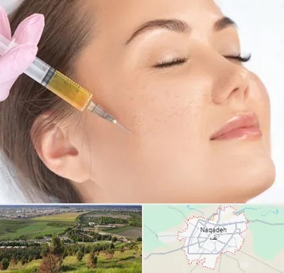 آموزش تزریق ژل و بوتاکس در نقده