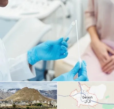 دکتر زگیل تناسلی HPV در گراش