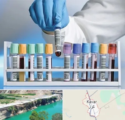 آزمایشگاه شبانه روزی در کوار
