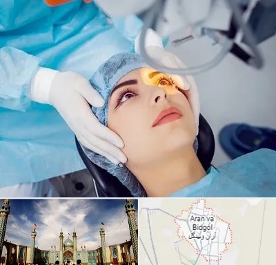 دکتر عمل لیزیک چشم در آران و بیدگل