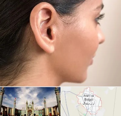 عمل گوش بل در آران و بیدگل