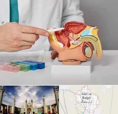 دکتر اورولوژی در آران و بیدگل