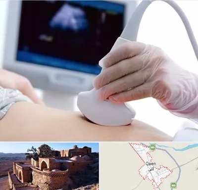 سونوگرافی در قائن