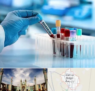 آزمایشگاه خون قبل از ازدواج در آران و بیدگل