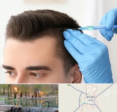 مزوتراپی مو در بروجن