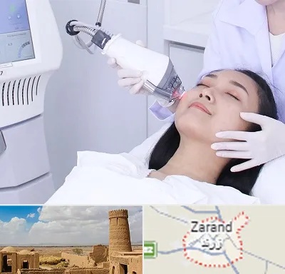 وایتنینگ در زرند