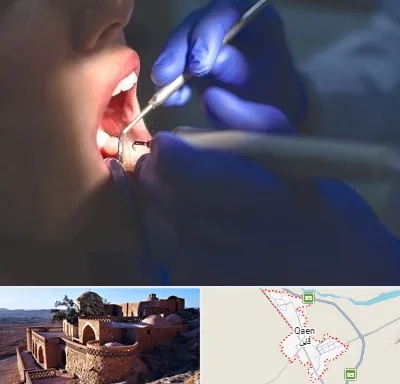 عصب کشی در قائن