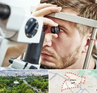 فوق تخصص قرنیه در البرز