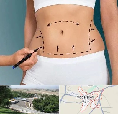دکتر طب سنتی برای لاغری در مبارکه