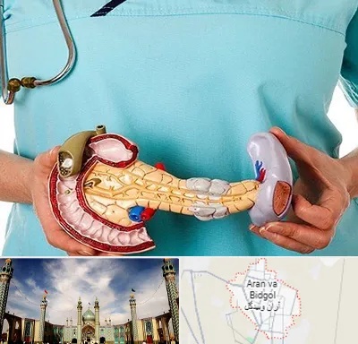 جراح سرطان لوزالمعده در آران و بیدگل