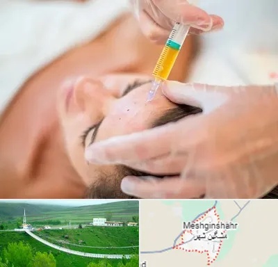 پی آر پی در مشگین شهر