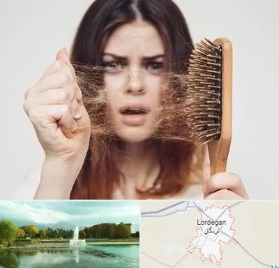 دکتر ریزش مو در لردگان