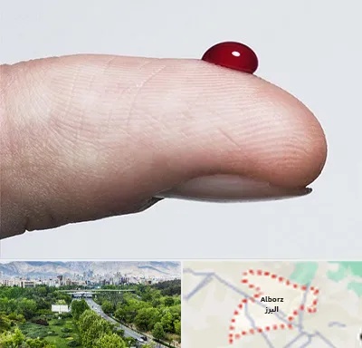 مرکز فصد خون در البرز