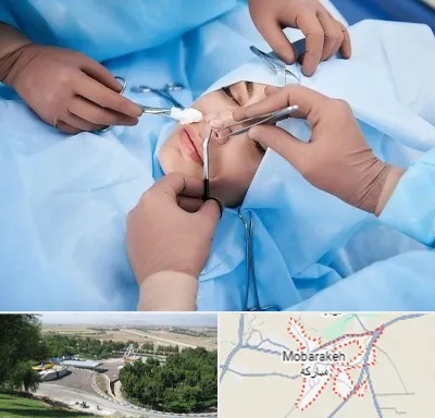 عمل بینی فانتزی در مبارکه