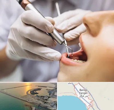 دندانپزشکی ارزان در بندر کنگان