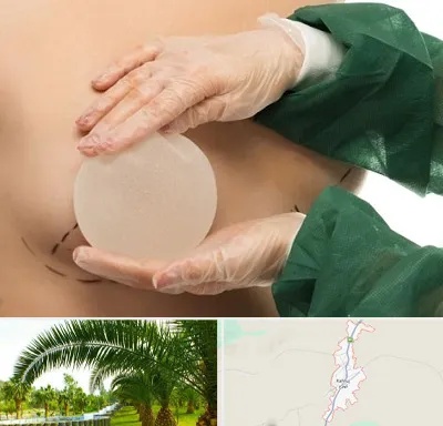 جراحی پروتز سینه در کهنوج