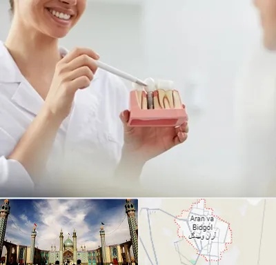 دکتر دندانساز در آران و بیدگل