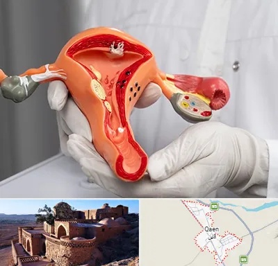 دکتر سرطان رحم در قائن