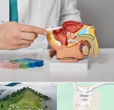دکتر اورولوژی در ماسال