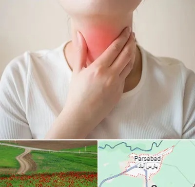 دکتر سرطان مری در پارس آباد