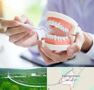 دندانسازی در مشگین شهر