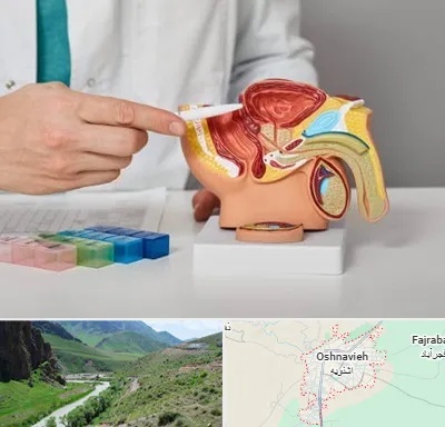 دکتر اورولوژی در اشنویه