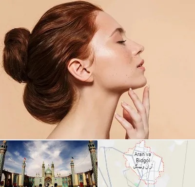 جراحی غبغب در آران و بیدگل