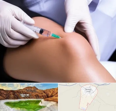 پلاسما درمانی PRP در گرمسار