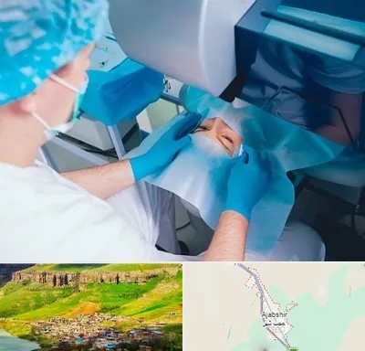 دکتر عمل لازک چشم در عجب شیر