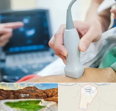 اکو قلب شبانه روزی در گرمسار