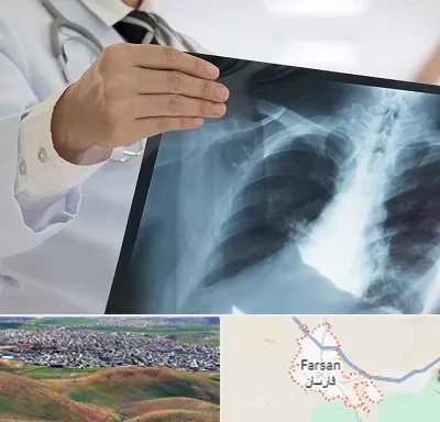 فوق تخصص ریه در فارسان
