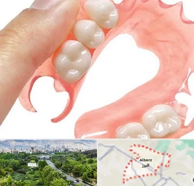 پروتز متحرک دندان در البرز