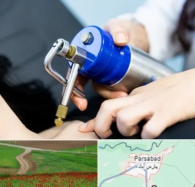 کرایوتراپی در پارس آباد