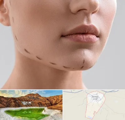 عمل زاویه فک در گرمسار