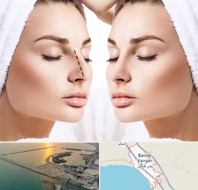 عمل بینی در بندر کنگان